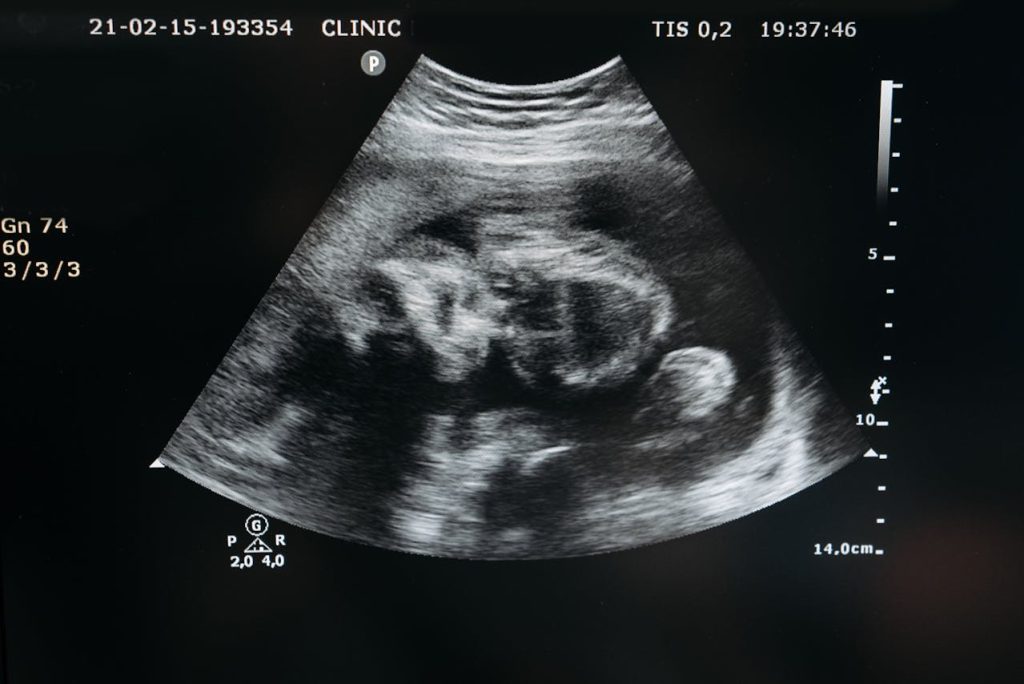 CRP level during pregnancy